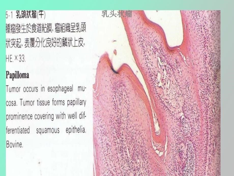 肿瘤病理变化_第5页