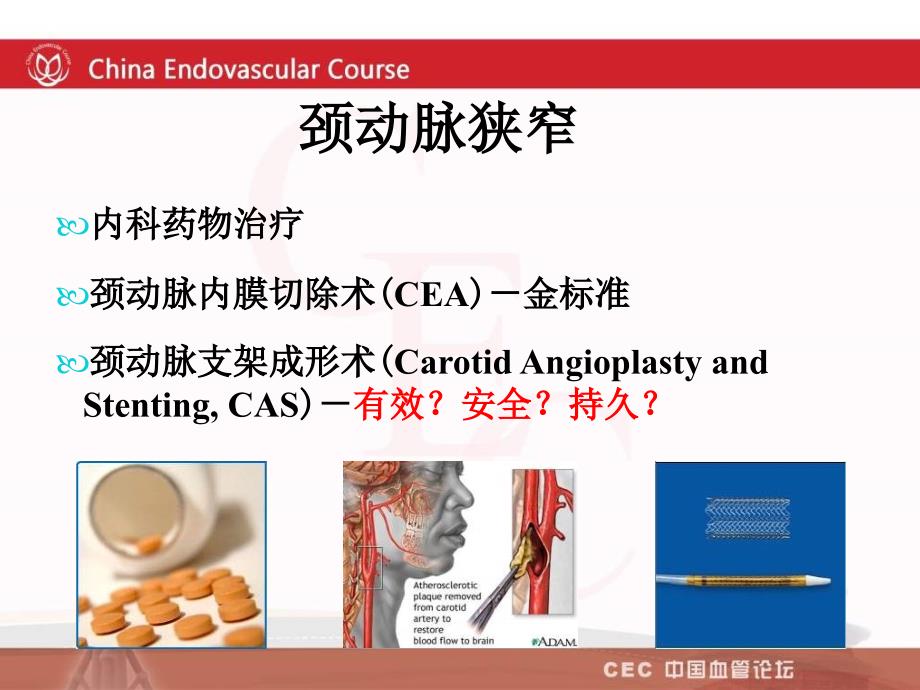 颈动脉cas术中术后并发症的防治郭大乔_第2页