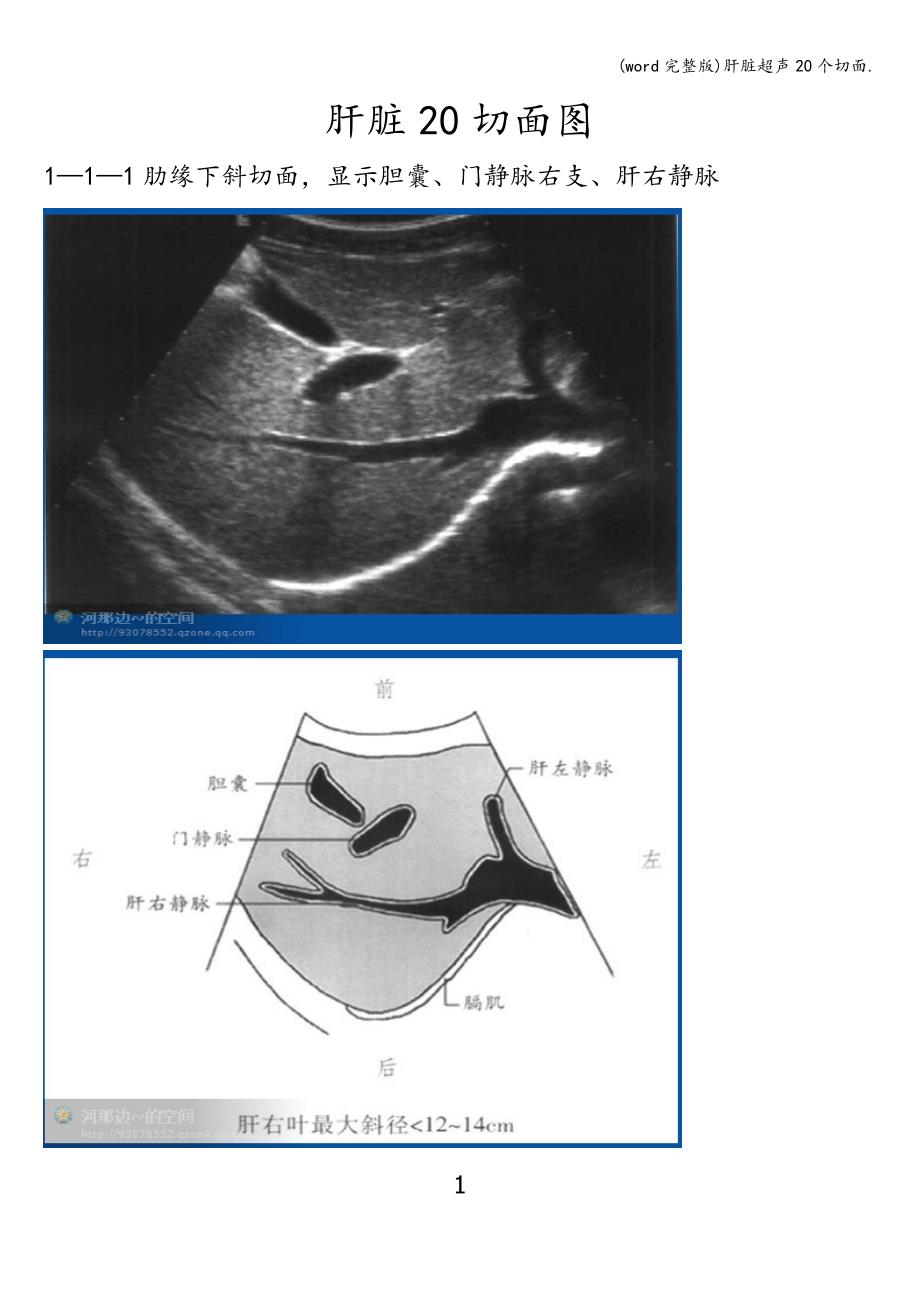 (word完整版)肝脏超声20个切面..doc_第1页