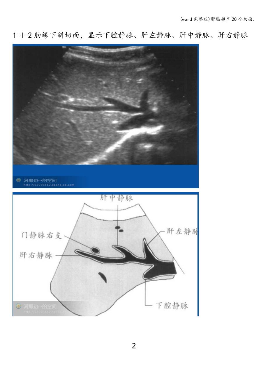 (word完整版)肝脏超声20个切面..doc_第2页