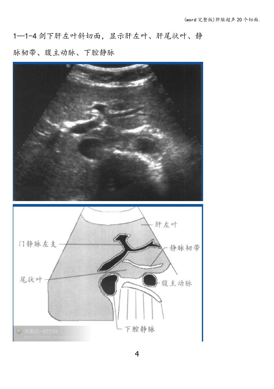 (word完整版)肝脏超声20个切面..doc_第4页