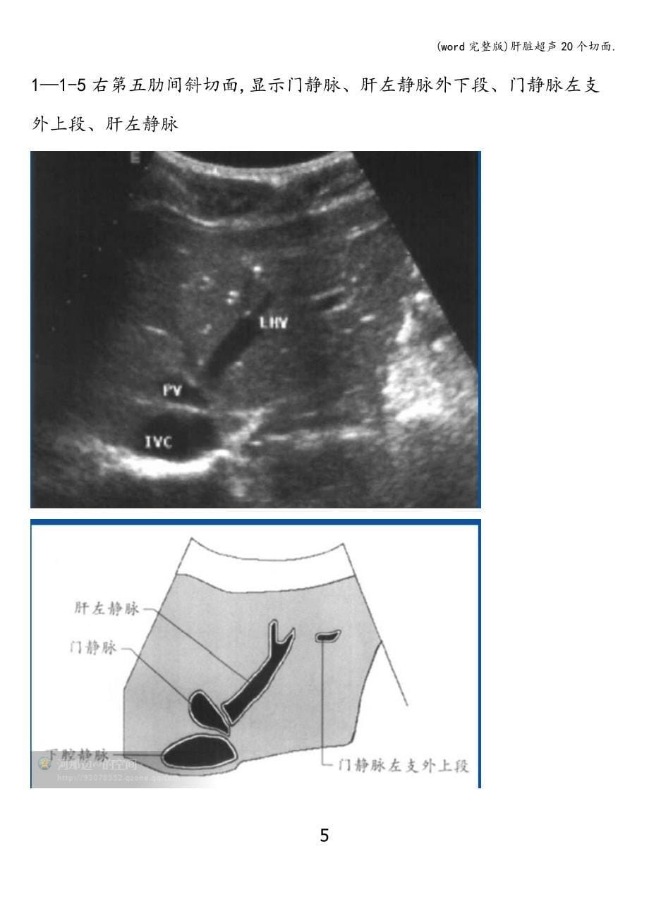 (word完整版)肝脏超声20个切面..doc_第5页