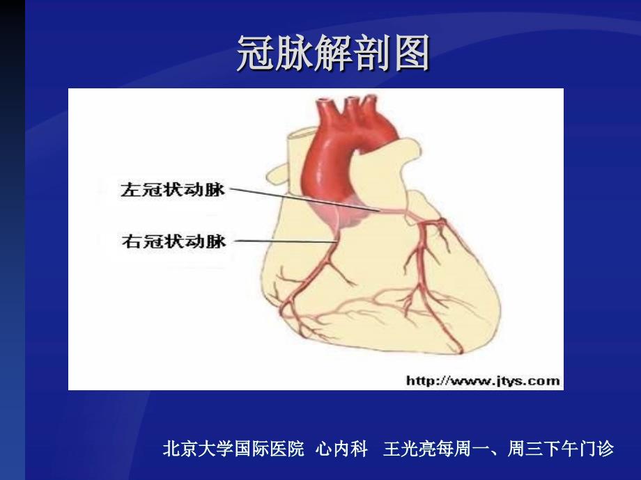 冠心病系统化诊治---北京大学国际医院-心内科-王光亮医生_第4页