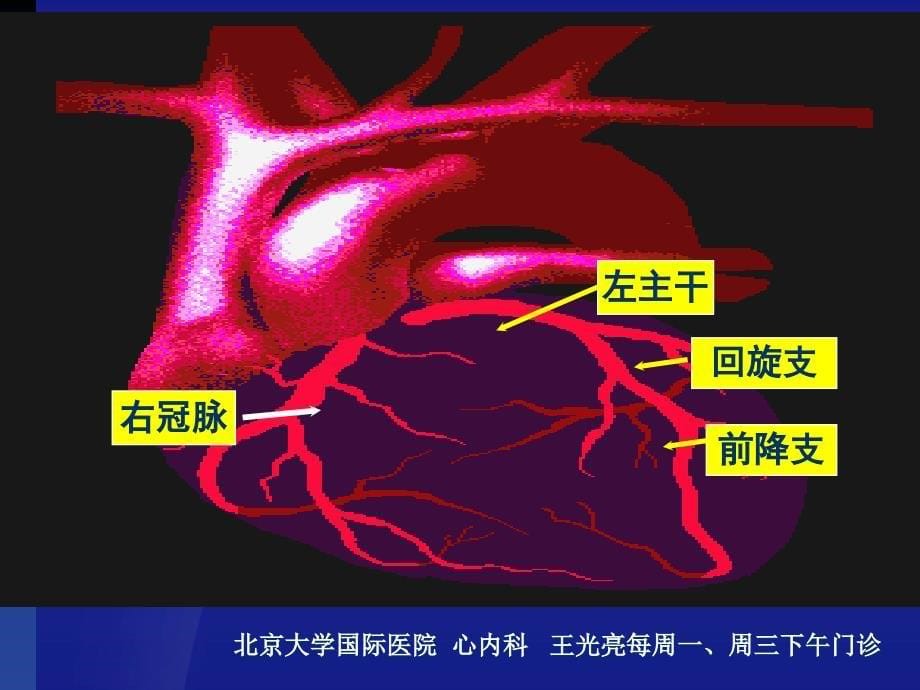 冠心病系统化诊治---北京大学国际医院-心内科-王光亮医生_第5页