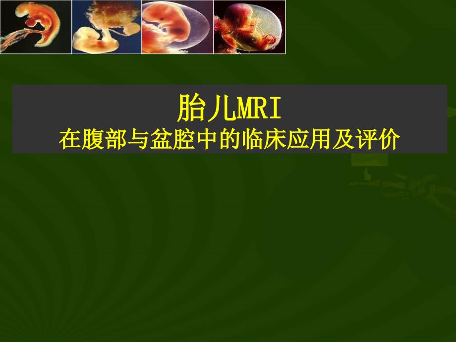 胎儿腹部MRI在腹部与盆腔中的临床应用及评价_第1页