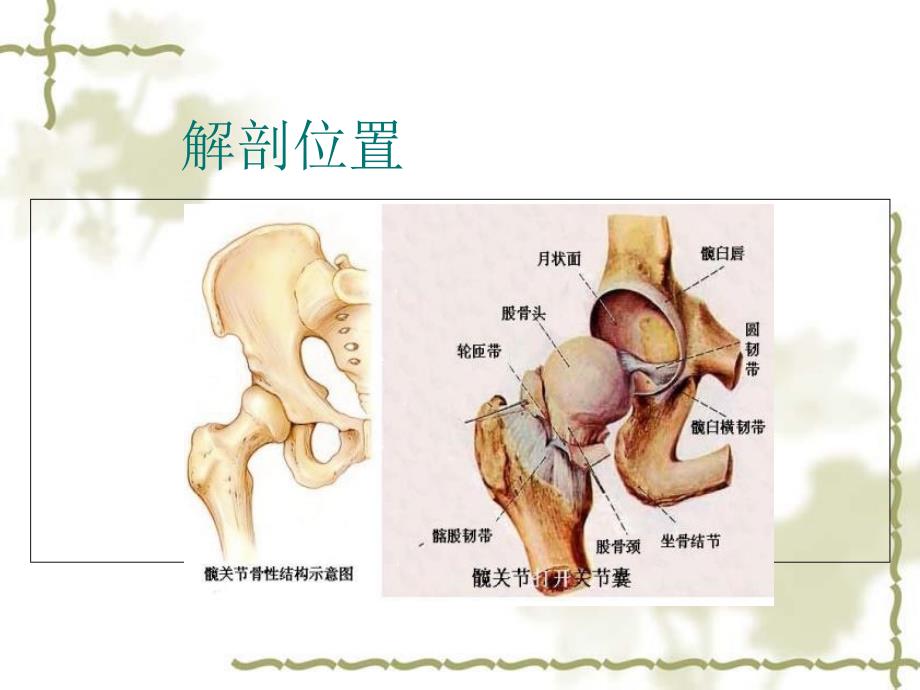 人工髋关节置换术护理_第4页