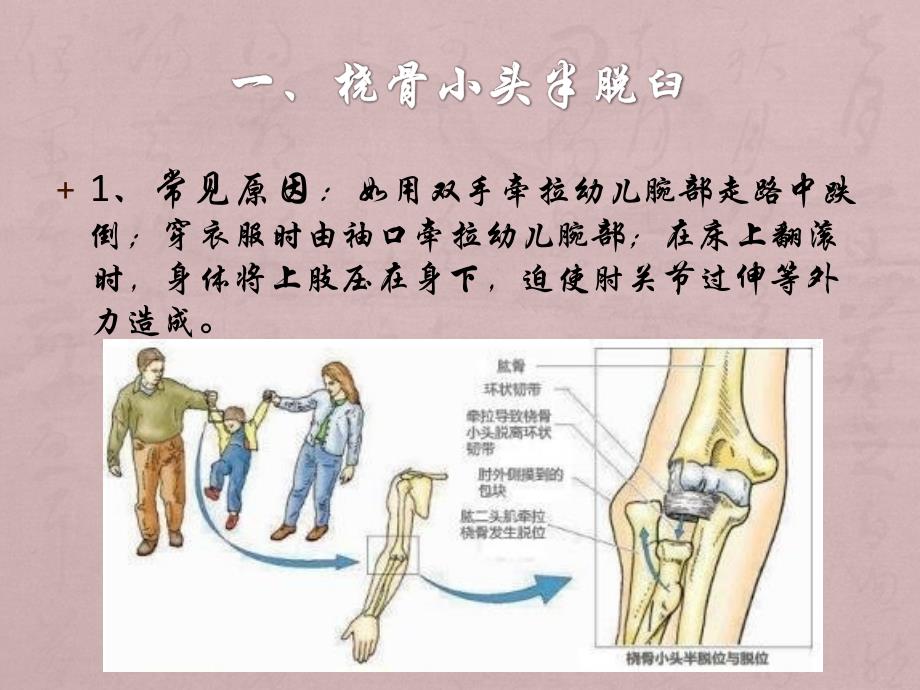 小儿意外伤害的急救与护理_第4页