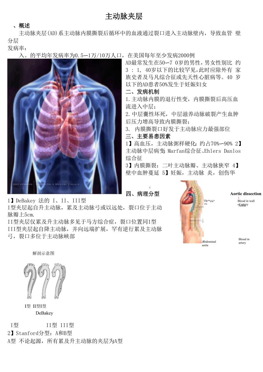 主动脉夹层_第1页