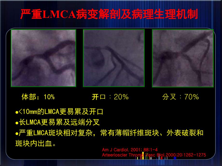 严重左主干病变放弃希望或是迎接挑战CABGvsPCI_第4页