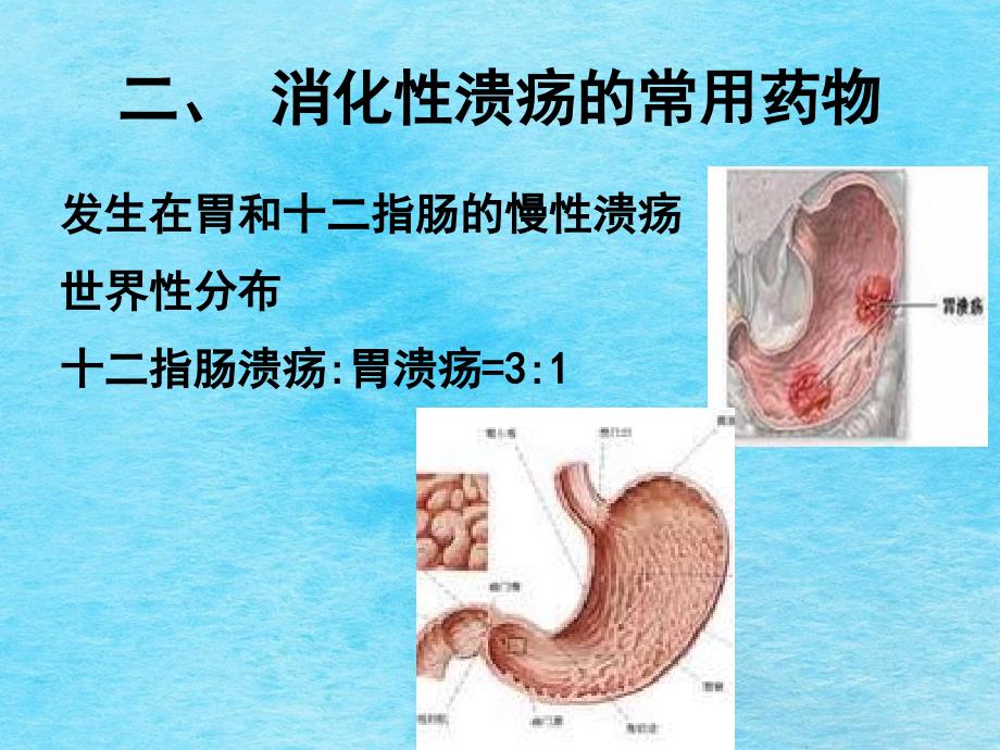 学习第10章消化系统疾病的常用药物ppt课件_第2页