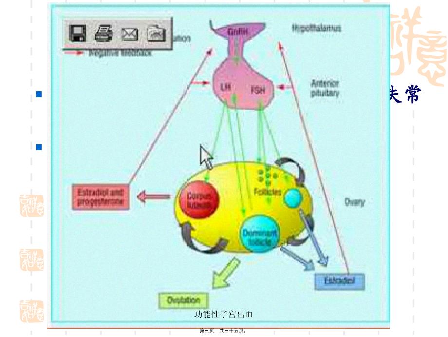 功能性子宫出血课件_第3页