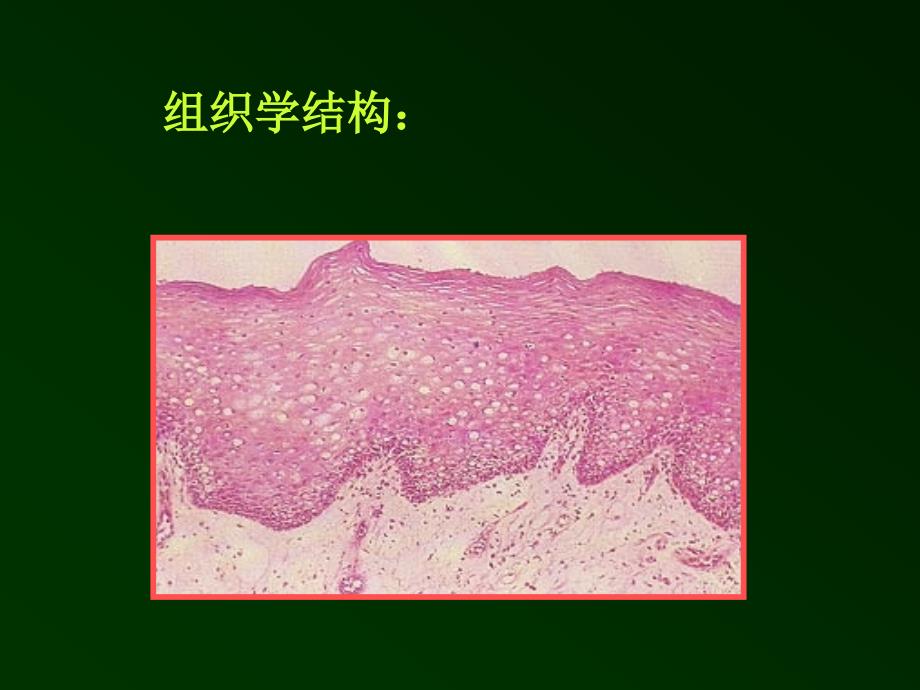 复发性阿弗他溃疡诊疗规范模板_第3页