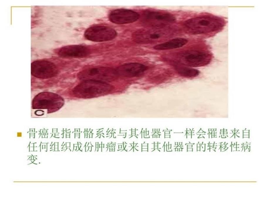 最新发育生物学课件发育异常与肿瘤精品课件_第5页