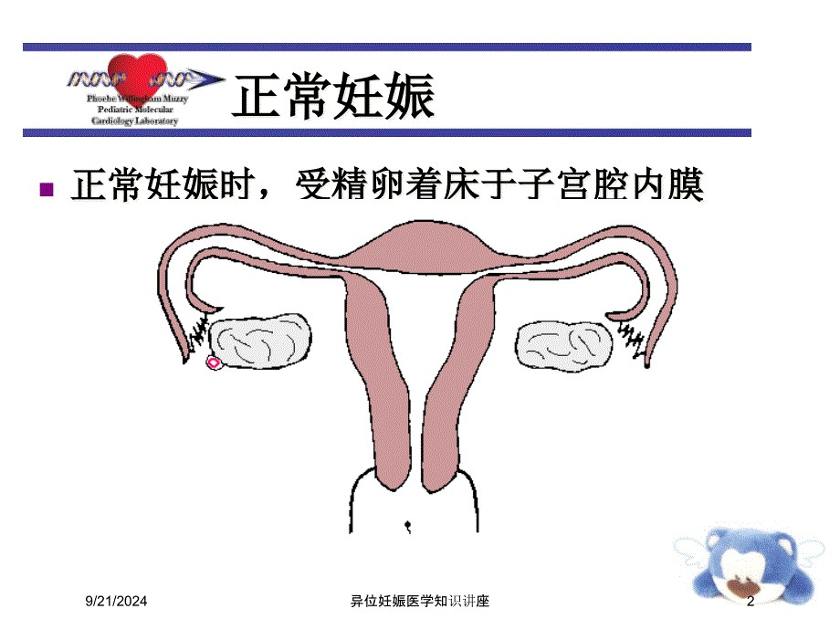 异位妊娠医学知识讲座培训课件_第2页