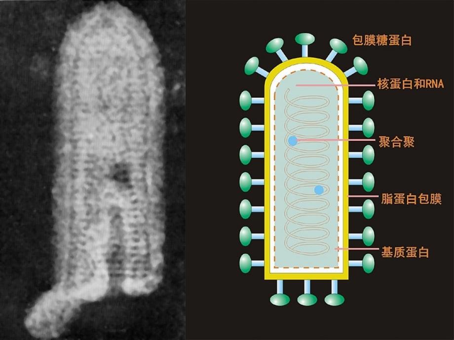 狂犬病病毒-医学微生物学课件_第5页