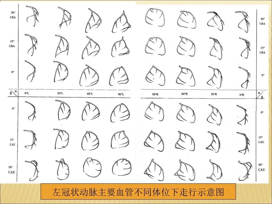 冠状动脉造影简介_第5页