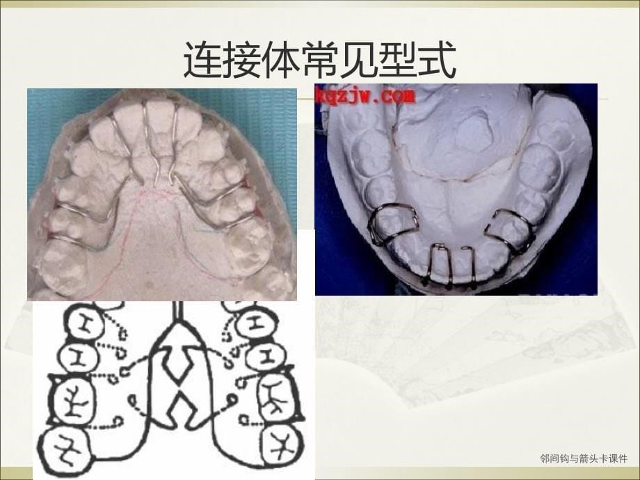 邻间钩与箭头卡课件_第5页