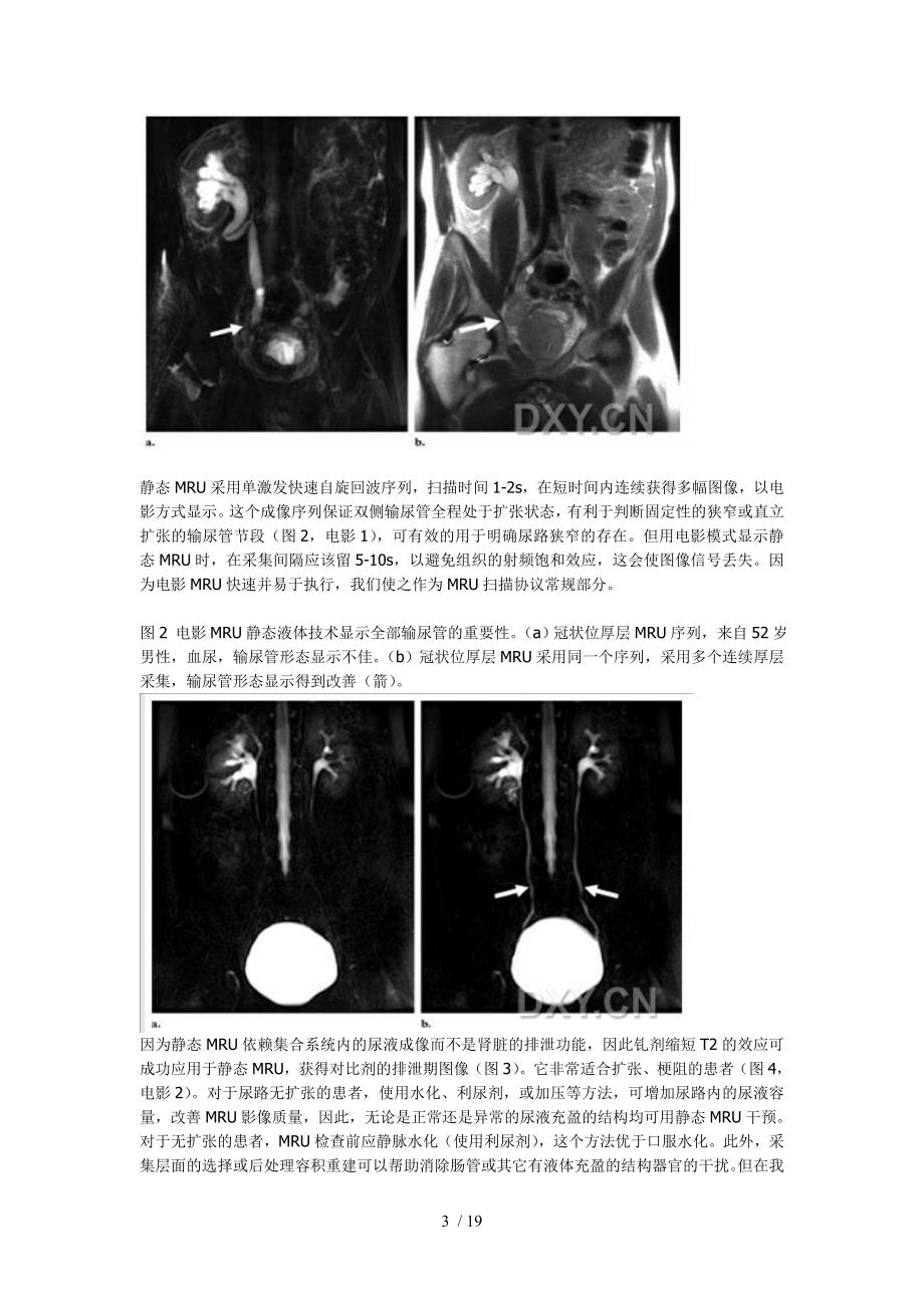 MRU成像技术和临床应用_第3页