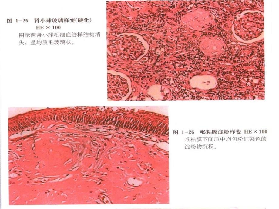 《医学病理图谱》PPT课件讲解学习_第4页