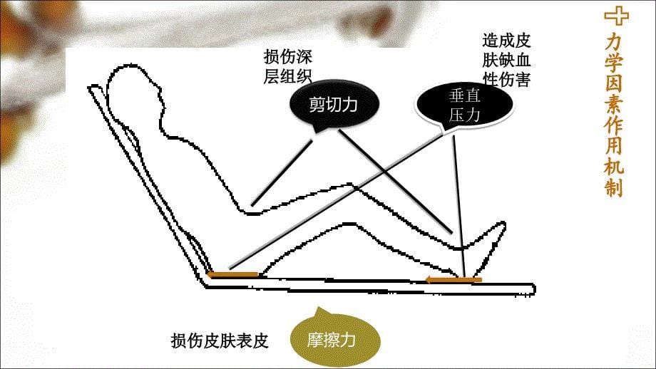 压力性损伤的预防ppt课件_第5页