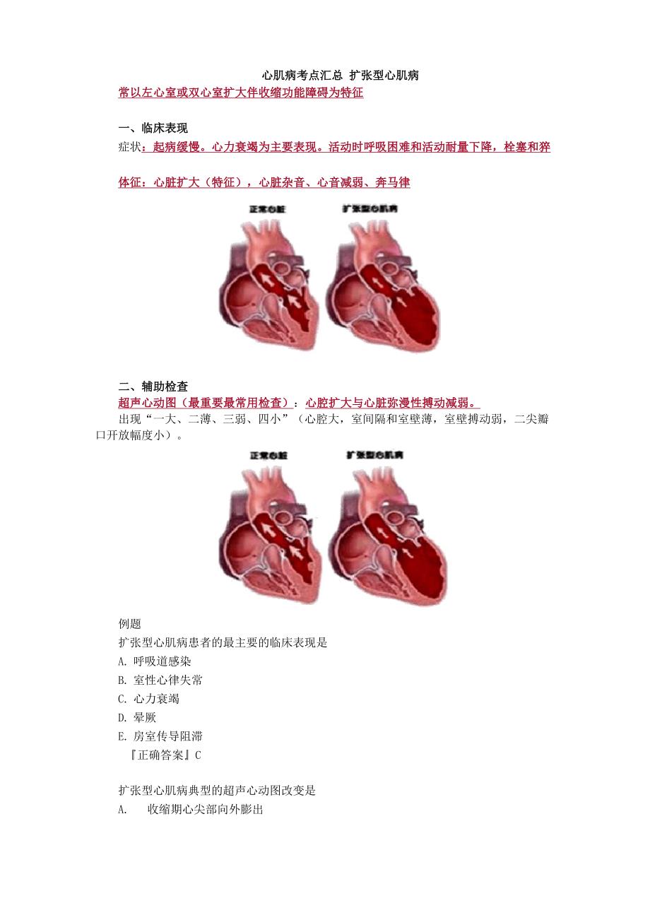 心肌病考点汇总_第1页
