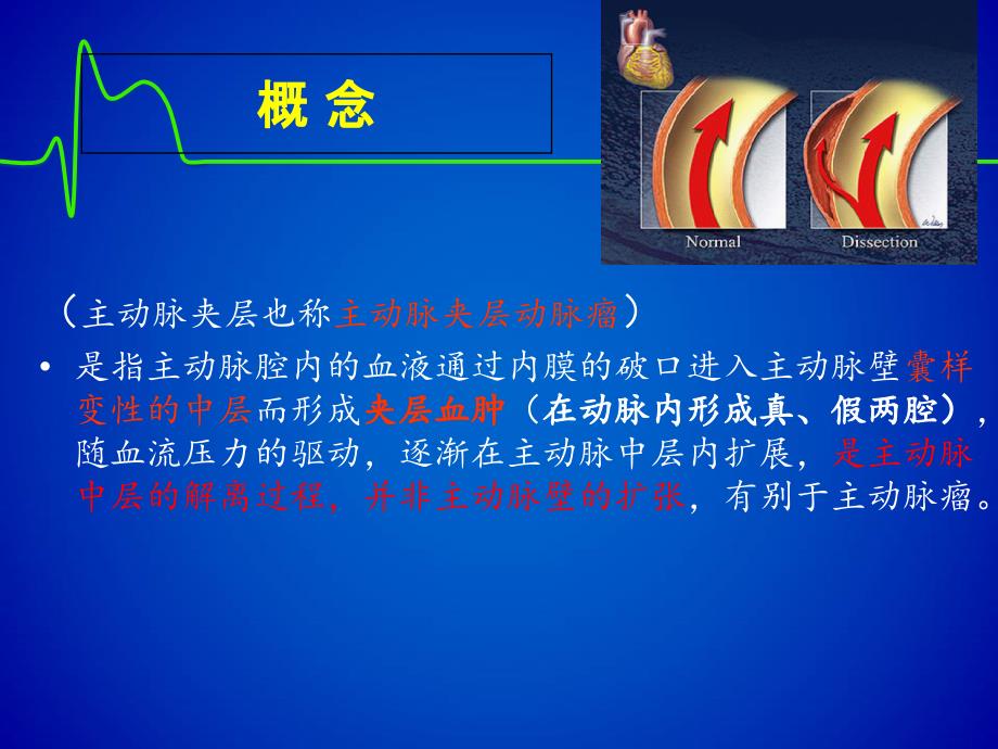 主动脉夹层修改版_第3页