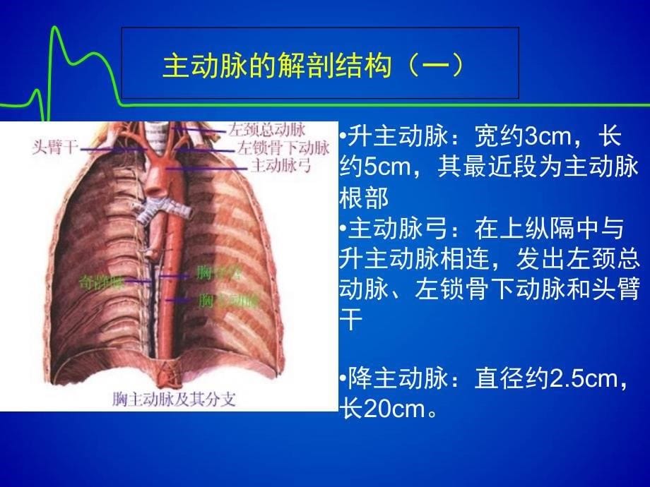 主动脉夹层修改版_第5页