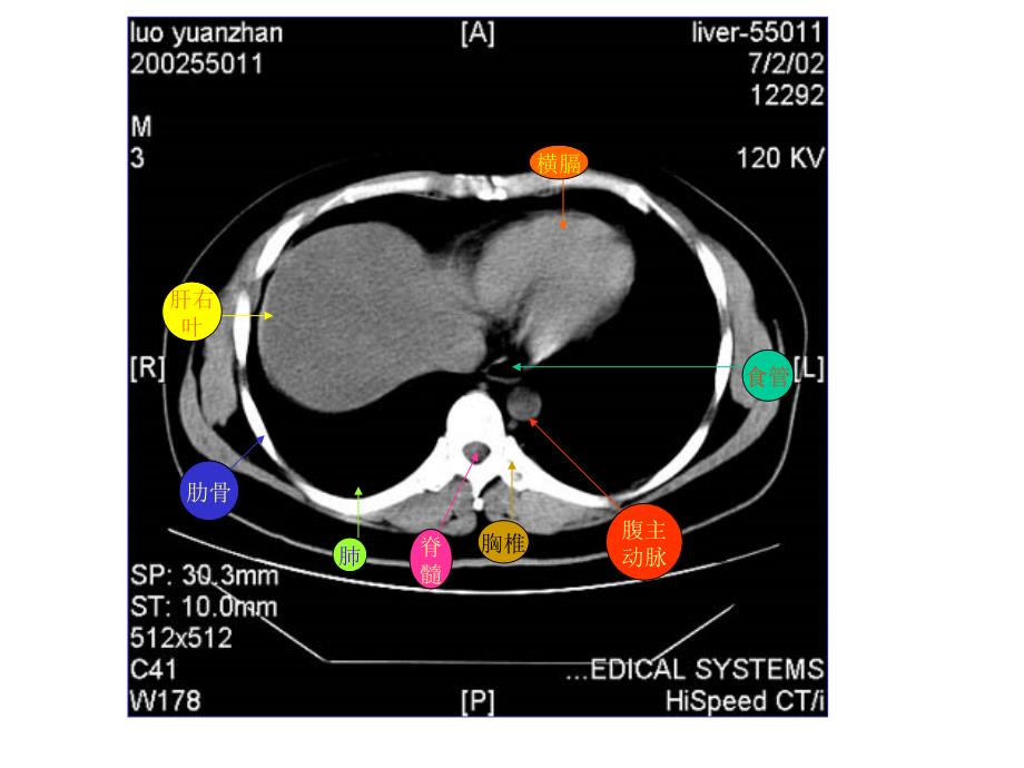 教你认识腹部CTPPT课件_第1页
