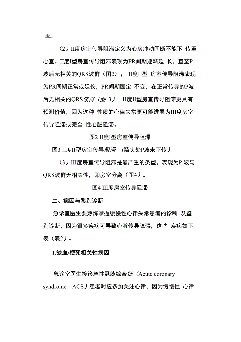 急诊缓慢性心律失常的诊断与处理_第4页