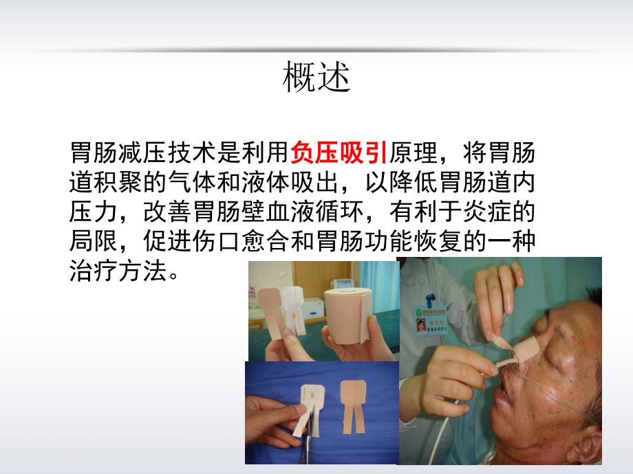 胃肠减压的护理课件.ppt_第3页