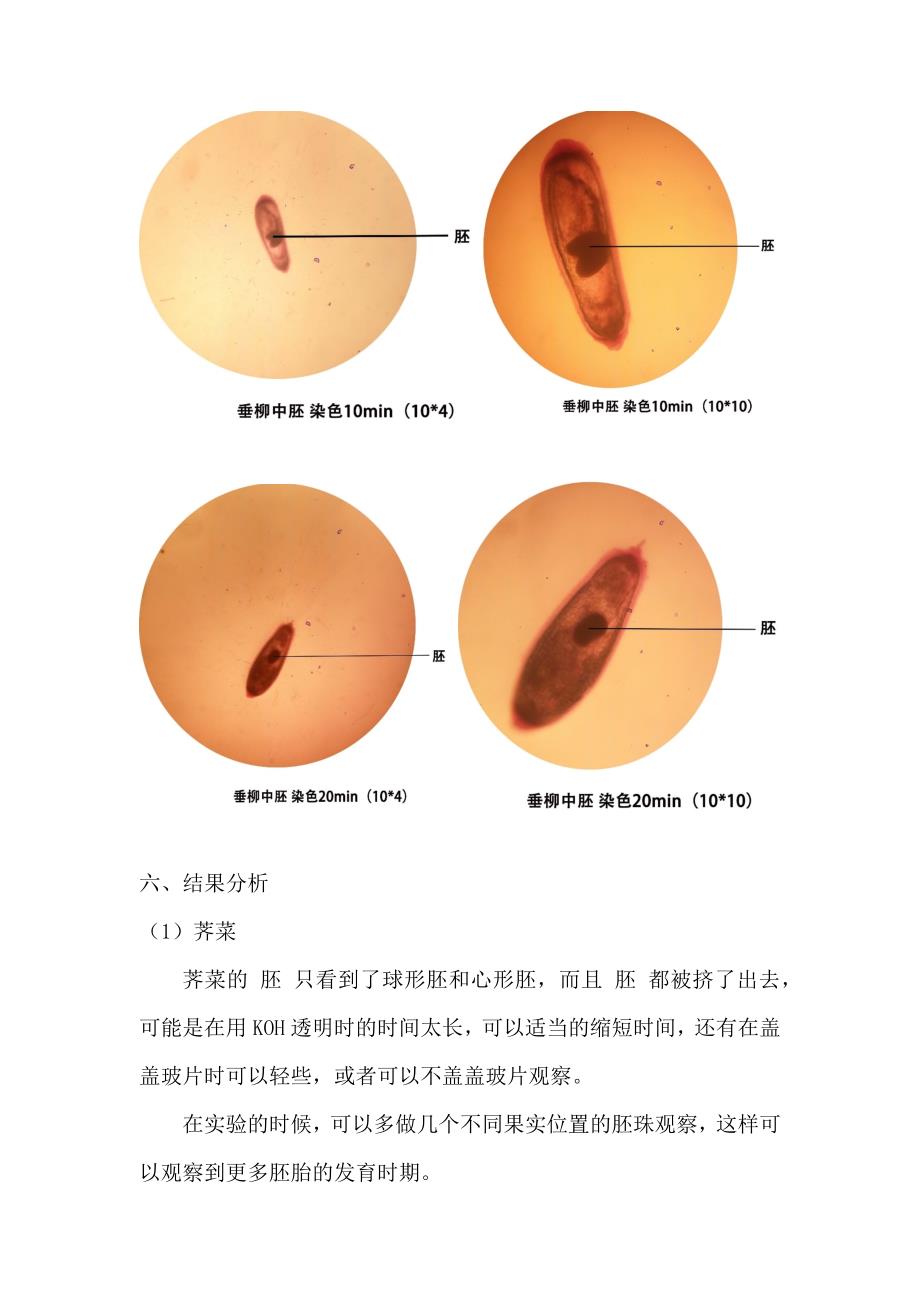 实验报告-被子植物果实的结构观察_第4页