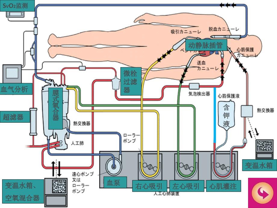 体外循环设备与实施_第4页