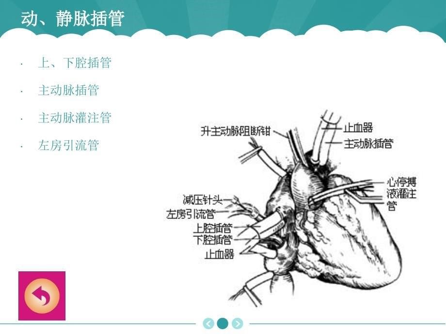 体外循环设备与实施_第5页