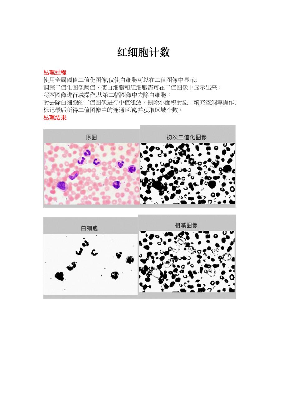 图像处理—红细胞计数Matlab_第1页