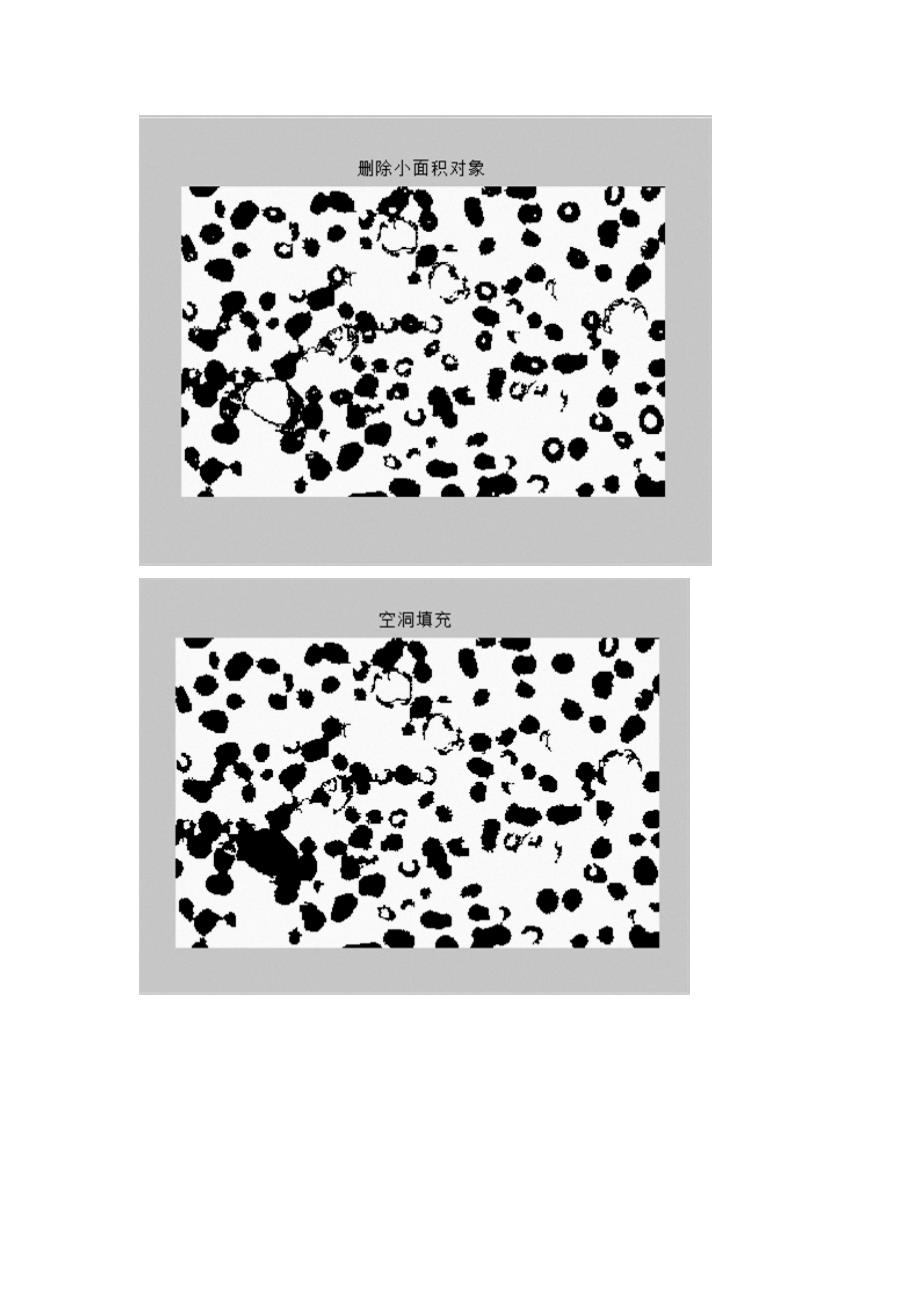 图像处理—红细胞计数Matlab_第2页