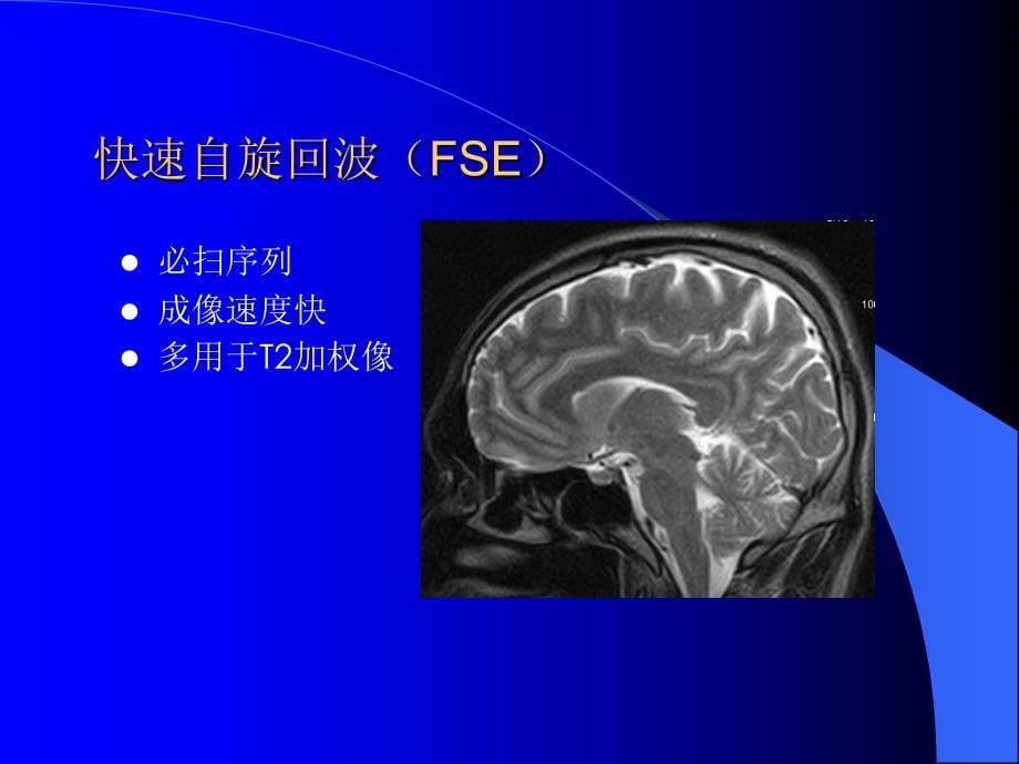 MRI-序列和适应症课件_第5页