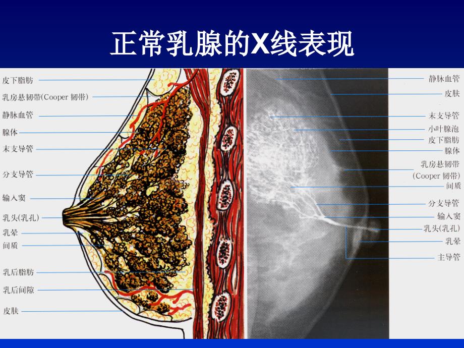 全数字化乳腺机的临床应用PPT文档_第1页