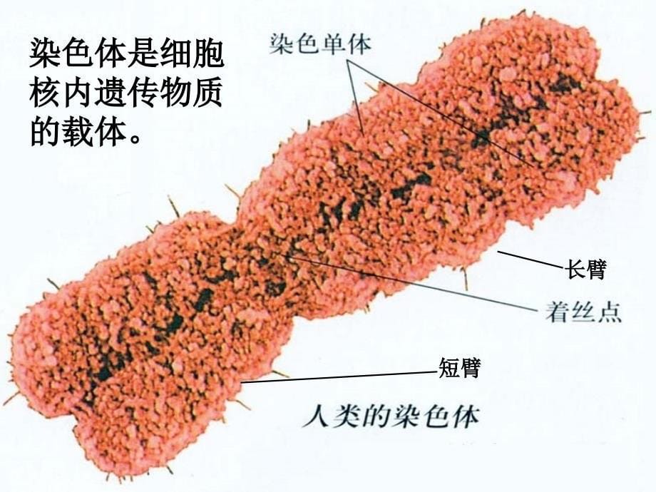 唐氏综合症是人类最常见的一种染色体病_第5页