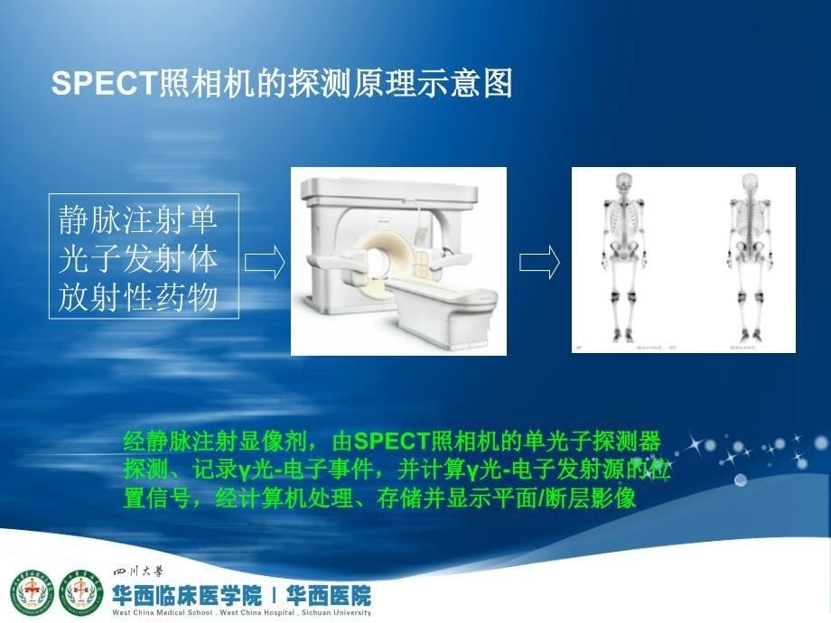 全身骨显像骨显像核医学.ppt_第5页