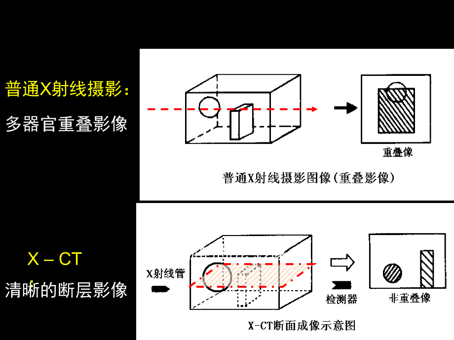 第二章CT成像原理_第2页