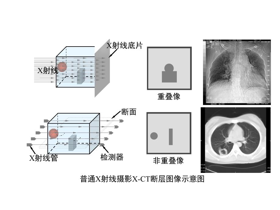 第二章CT成像原理_第3页