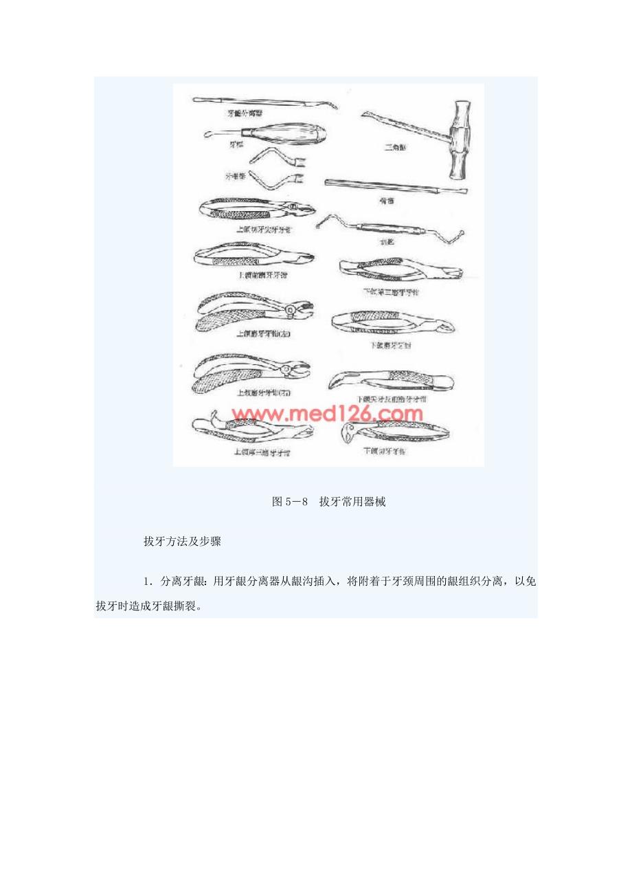 拔牙操作步骤.doc_第3页