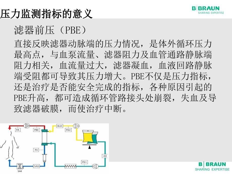 CRRT压力监测、报警及处理资料_第5页