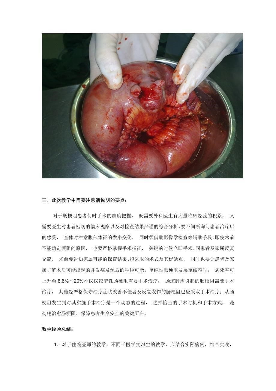 外科教学查房教案_第5页