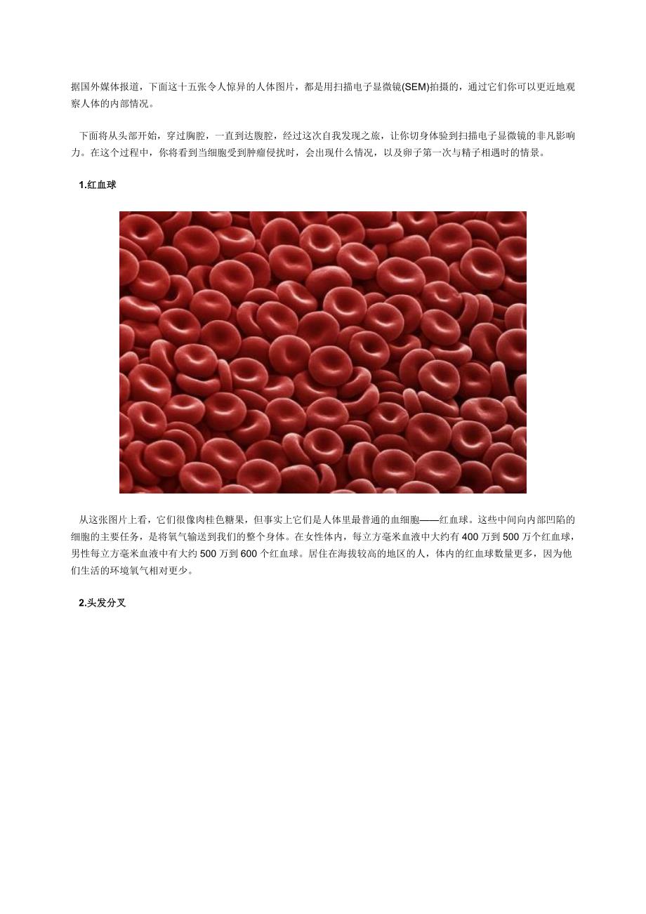 电子显微镜SEM拍摄的人体图片_第1页