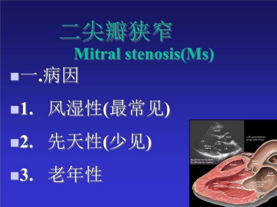 最新彩超瓣膜病1PPT课件_第3页
