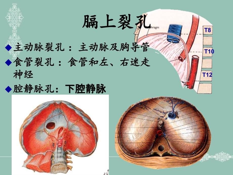 人体断面解剖学胸部文档资料_第5页