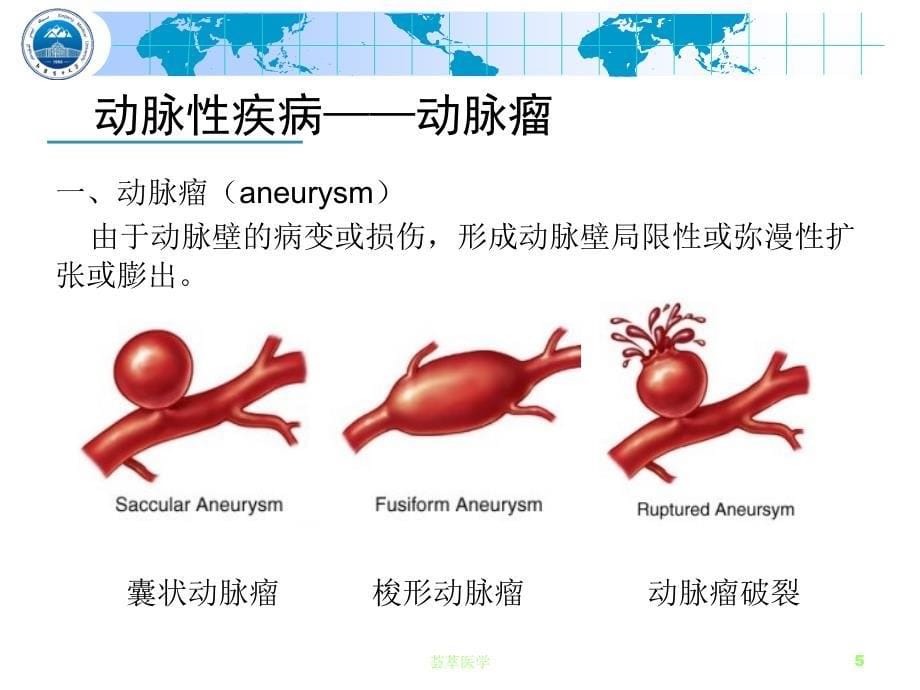 周围血管疾病专业医疗_第5页