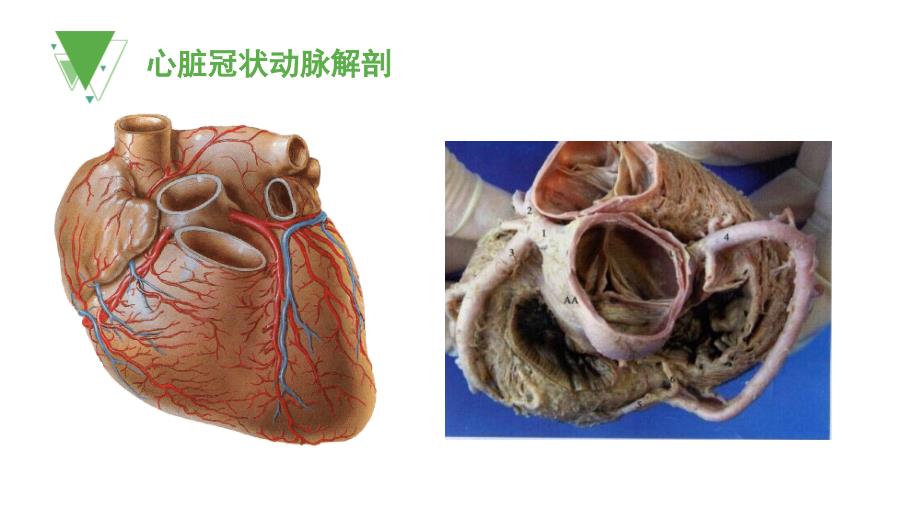 心脏冠脉CTA知识分享课件_第3页