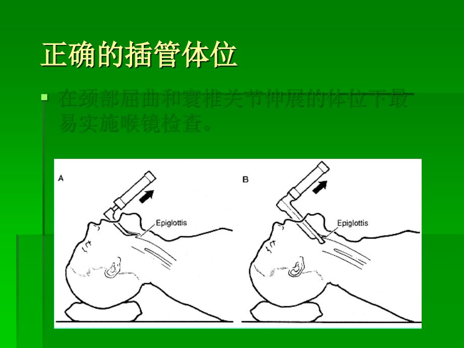 气管插管及困难气道_第4页